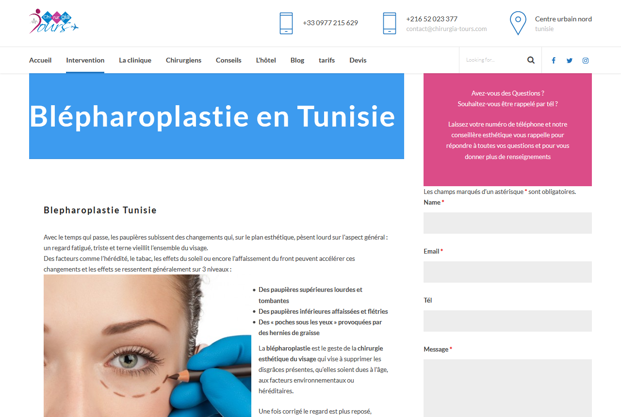 Détails : Blepharoplastie Tunisie 